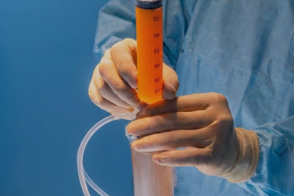 Medicina Rigenerativa in ortopedia: trapianto di cellule staminali